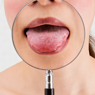 舌の症状でお困りの方へ